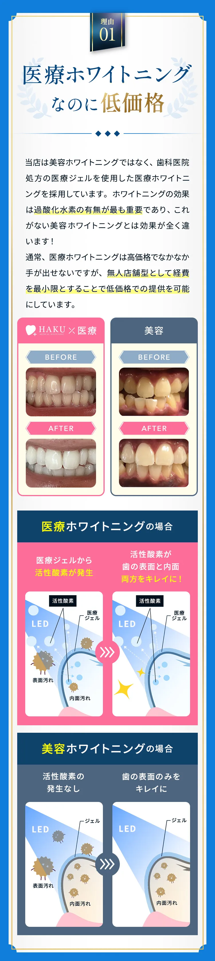 医療ホワイトニングなのに低価格